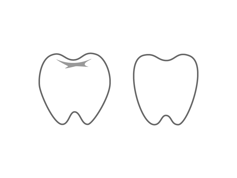 歯・奥歯イラスト素材01